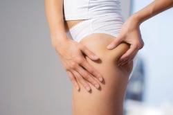 Warum haben Sie Probleme mit Cellulite?